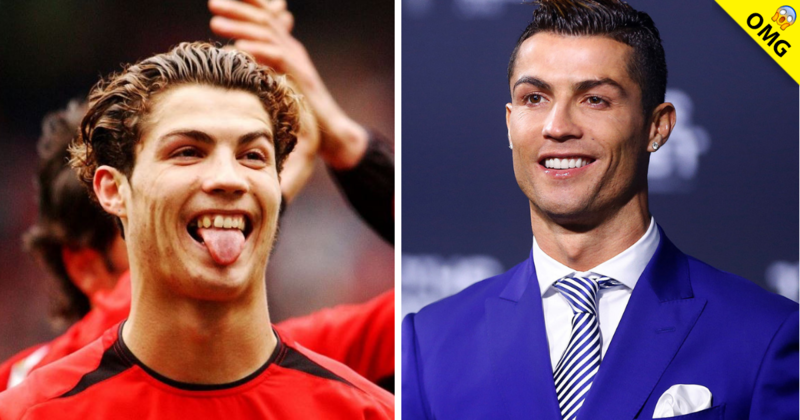 dientes de cristiano ronaldo